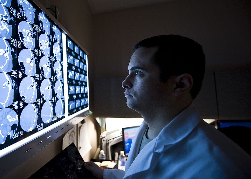 Male doctor in a white coat examining multiple brain scan images on large screens, representing the medical evaluation process in brain injury cases.
